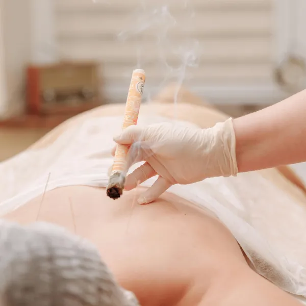 A moxibustion therapy session with acupuncture, showcasing traditional Chinese medicine techniques.
